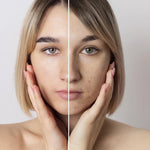 Masajeador facial Trendencias InstaGlow™ "Envio Gratis a todo Guatemala "