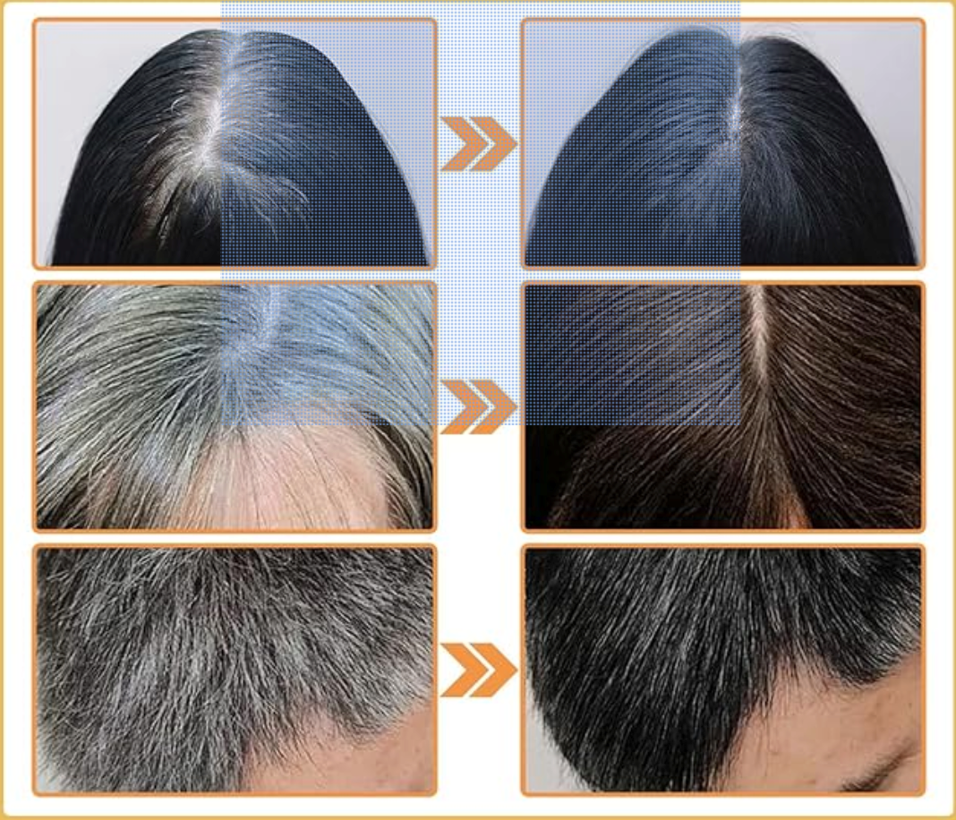 Serum Capilar de Ganoderma Nutrient Oscurecimiento 100% Natural + Envio Gratis